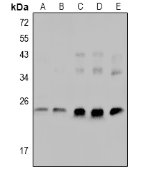 Ctni (Phospho S23/S24) Polyclonal Antibody