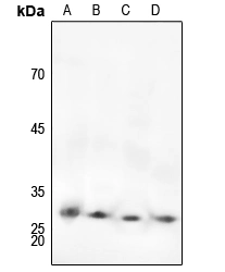 Ctni (Phospho S22/S23) Polyclonal Antibody